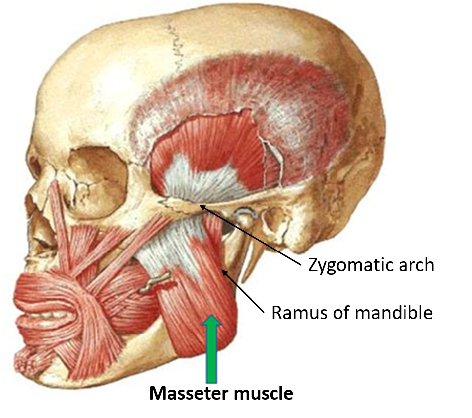masseter muscle