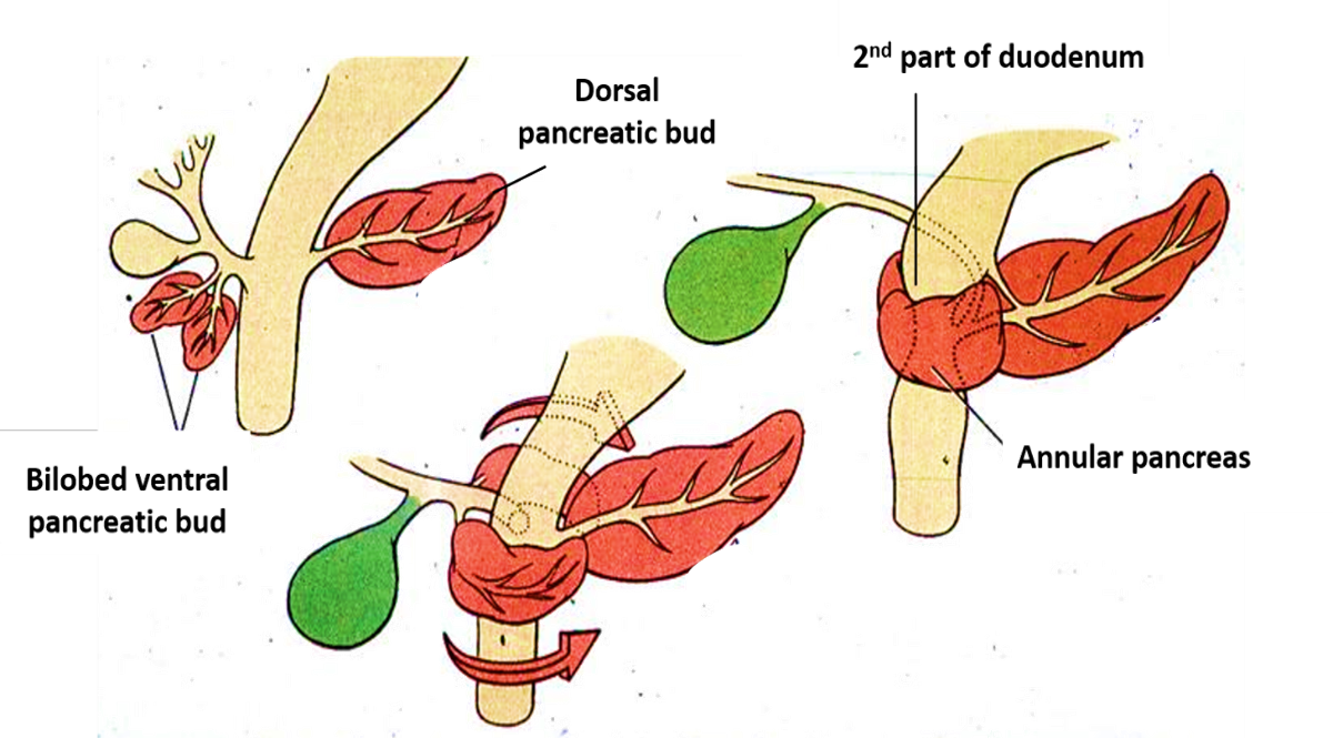 pancreas - annular
