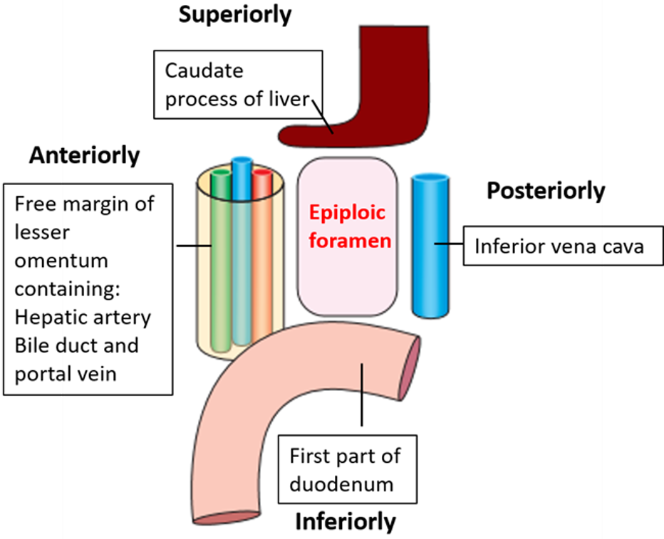 epiploic foramen - boundaries