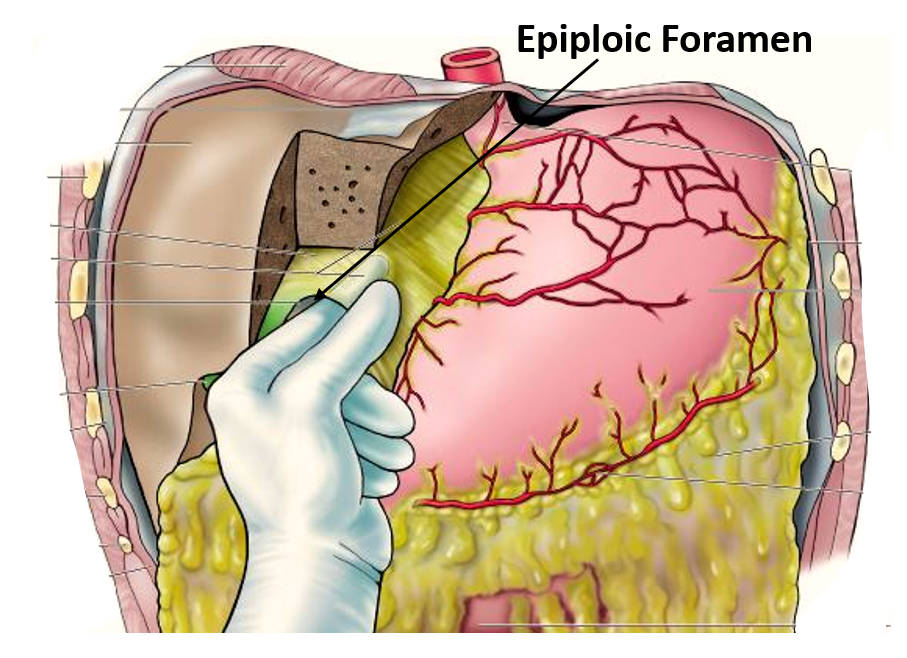 epiploic foramen - location