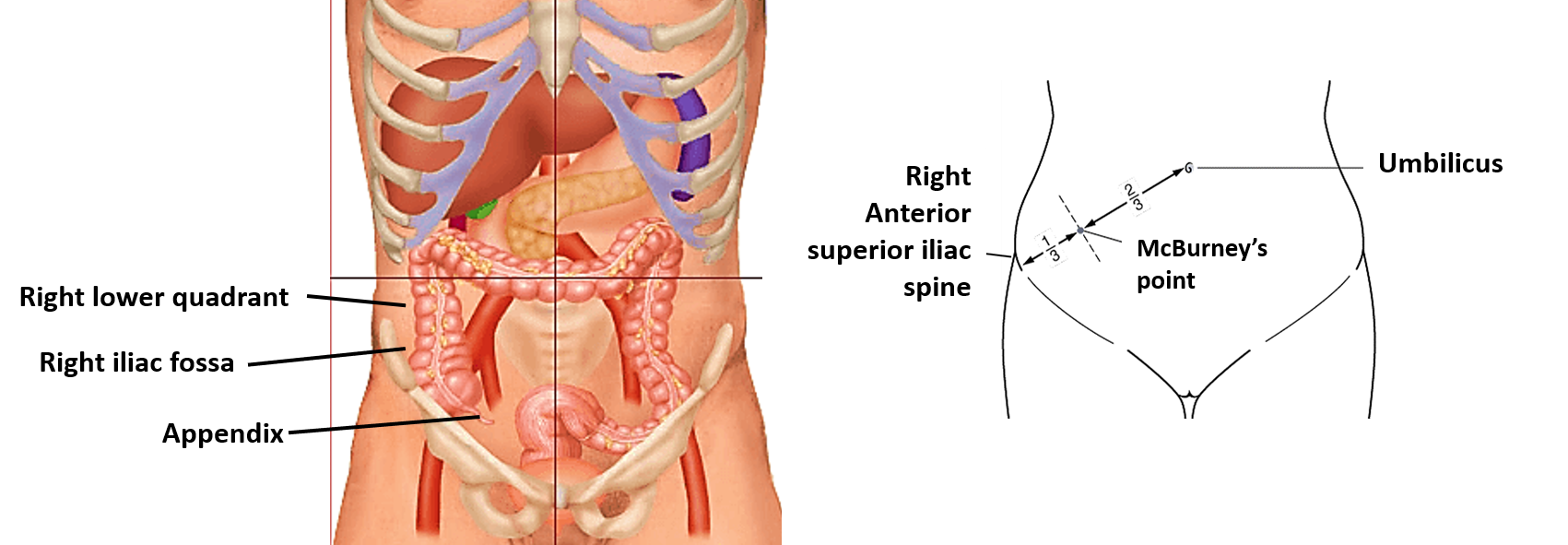 Vermiform Appendix , location, various positions, referred pain
