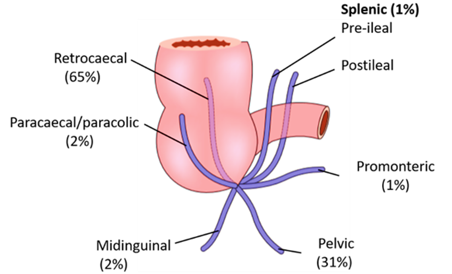 vermiform appendix - positions