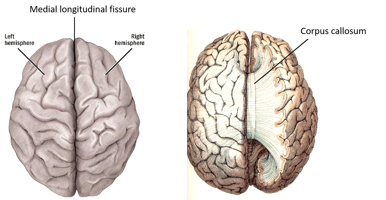 cerebral hemispheres