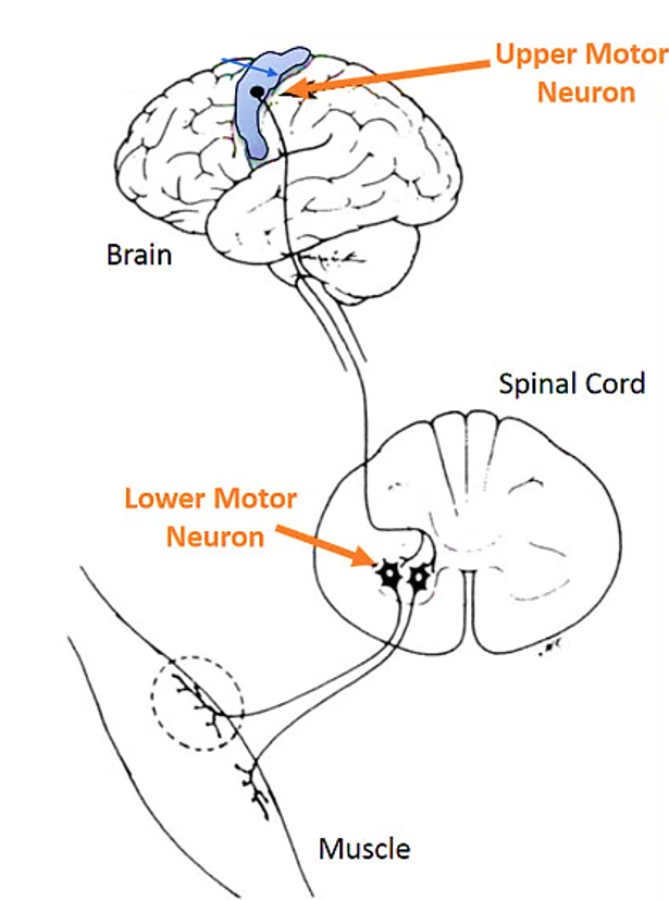 Upper and lower motor neurons