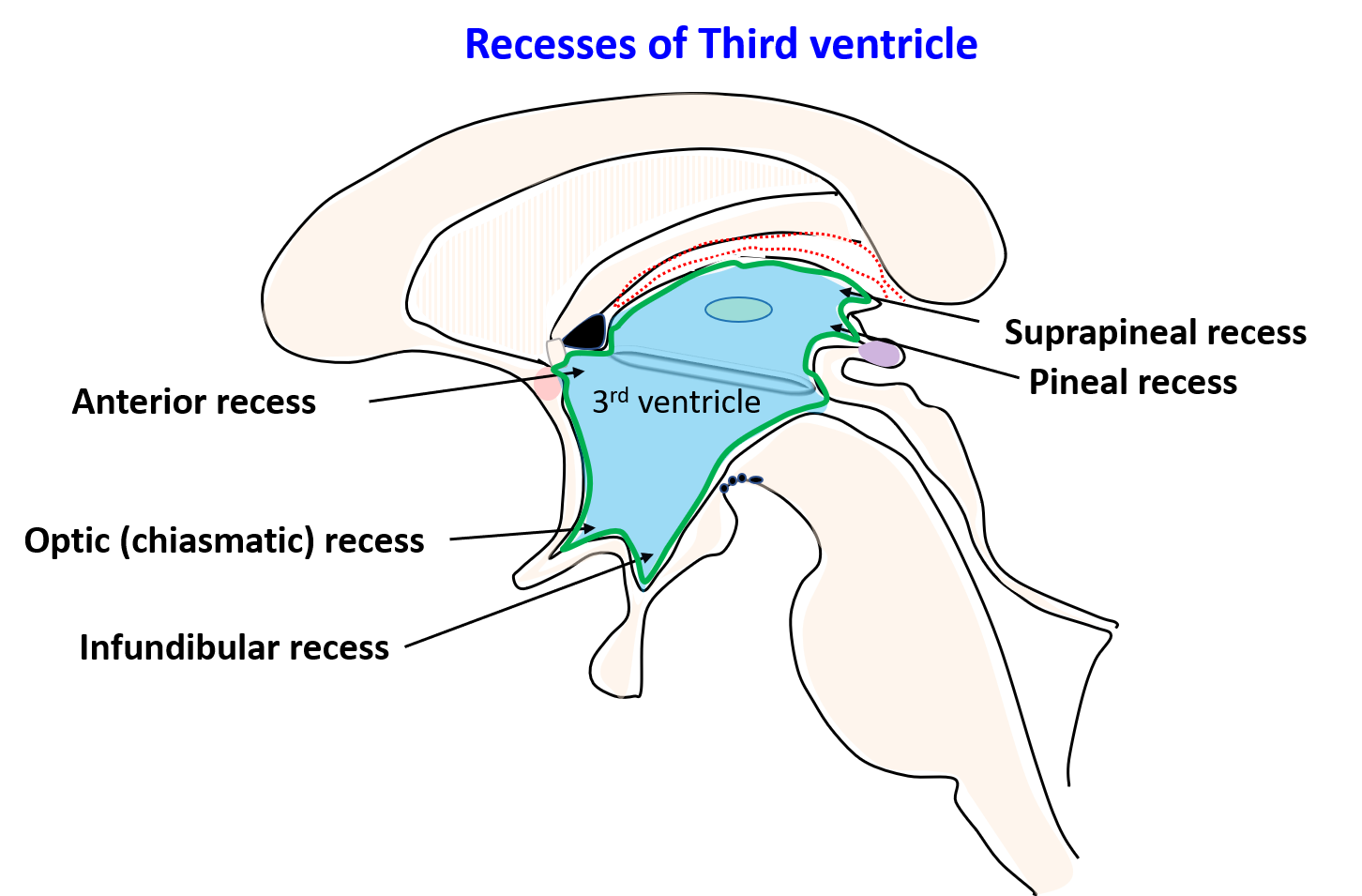  Recesses of third ventricle