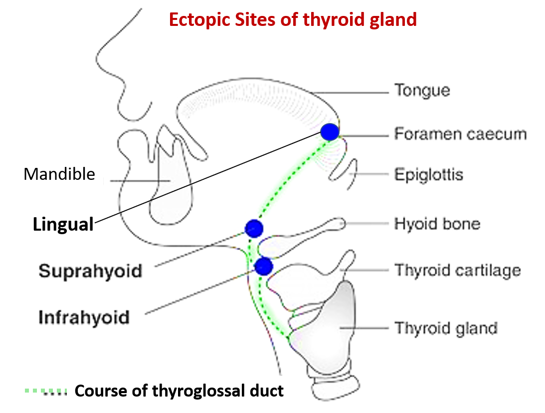 Ectopic sites of thyroid gland