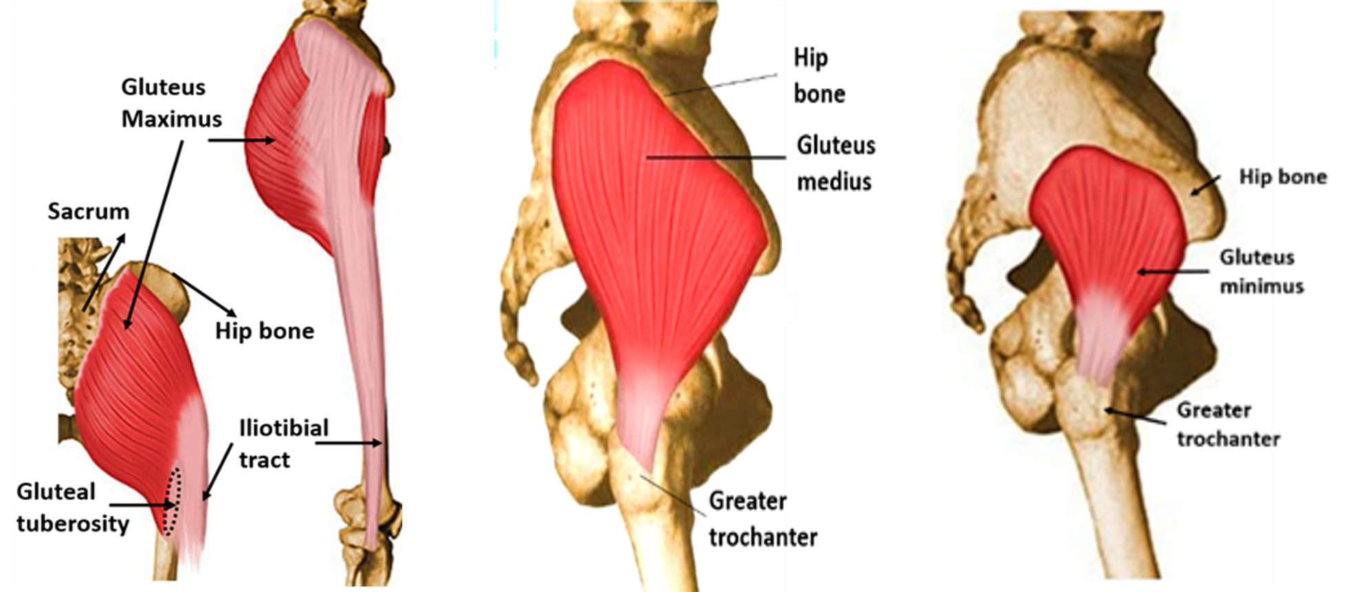 Gluteal Tuberosity Muscle Attachment Gluteus Maximus Muscle Pacs Gluteal Tuberosity Muscle Attachment Gluteus Maximus Muscle Pacs