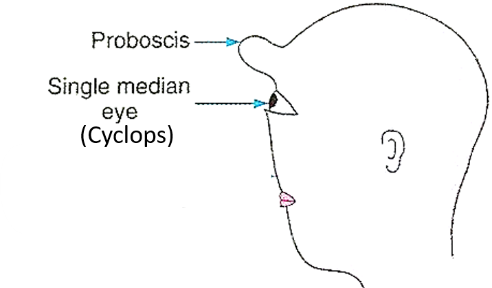 Probosis and cyclops