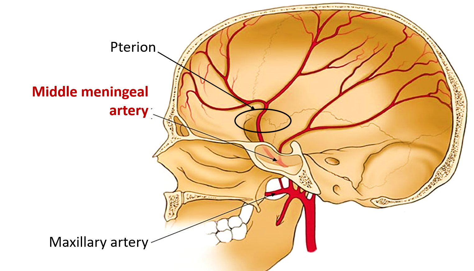 middle meningeal artery and pterion