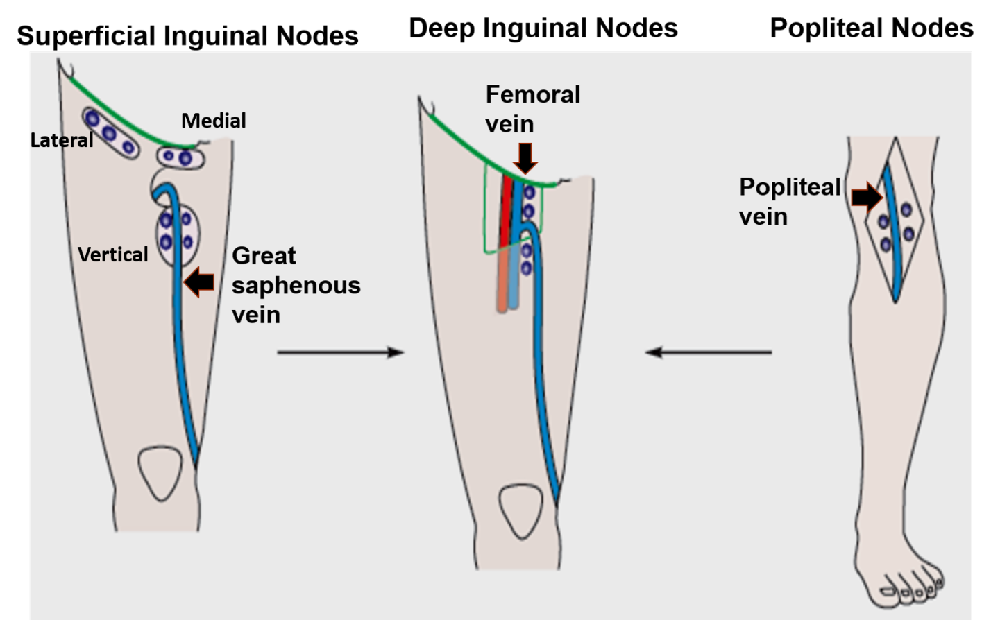 Lymphatic Drainage of Lower Limb , Anatomy QA