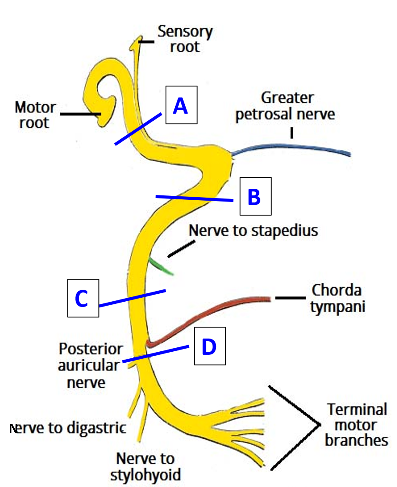 sites of lesion of facial nerve