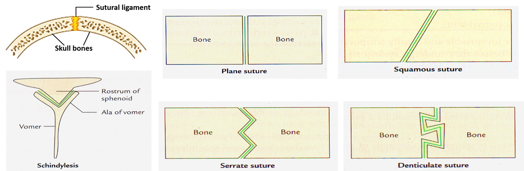 sutures -types